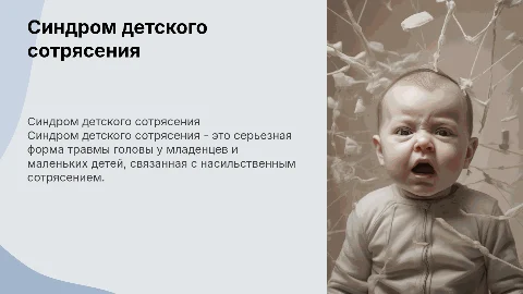 Синдром детского сотрясения