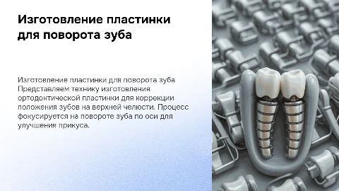 Техника изготовления пластинки для поворота зуба по оси