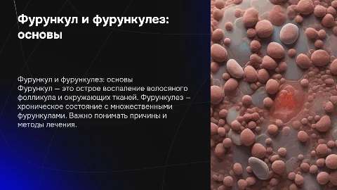 Фурункул, фурункулез