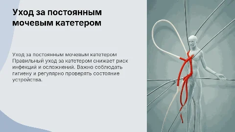 уход за постоянным мочевым катетером