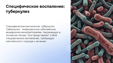 Презентация на тему специфическое воспаление туберкулез