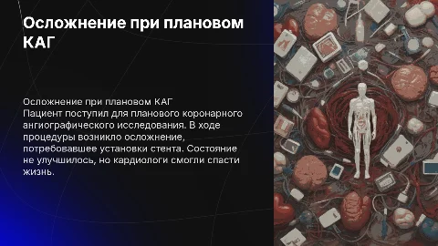 Осложнение при плановом КАГ: спасение жизни пациента