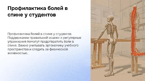 профилактика болей в спине у студентов