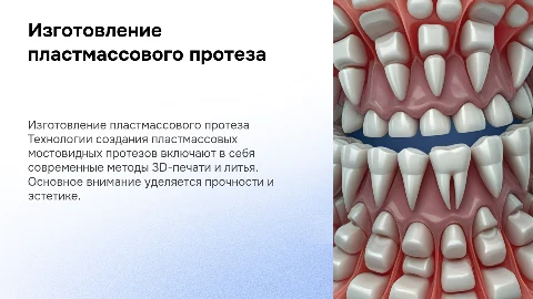 Технология изготовления пластмассового мостовидного протеза