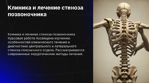 Курсовая работа по стенозу поясничного отдела позвоночника