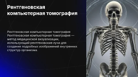 рентгеновская компьютерная томография
