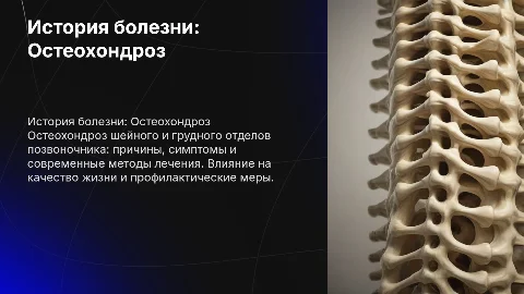История болезни остеохондроз шейного и грудного отдела