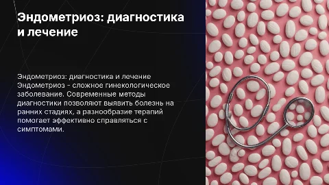 Эндометриоз: диагностика и лечение - подробное описание