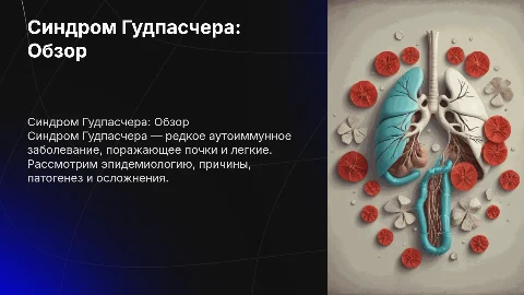 Синдром Гудпасчера: Эпидемиология, Этиология и Клинический случай