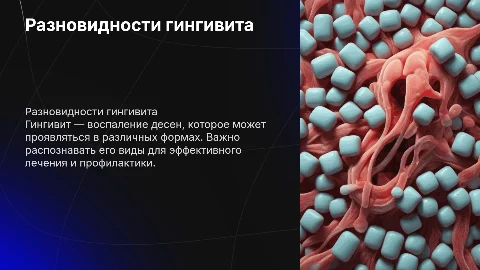 Виды гингивита