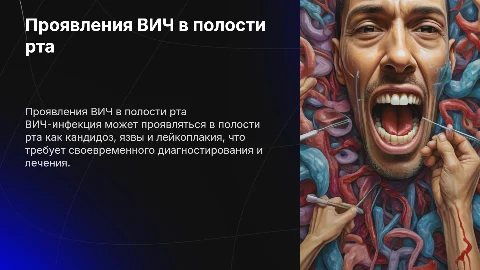 Проявления Вич инфекции в полости рта