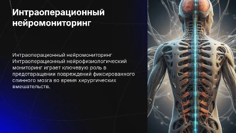 Интраоперационный нейрофизиологический мониторинг спинного мозга