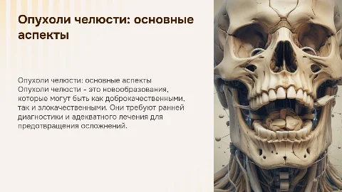 Опухолей челюсти