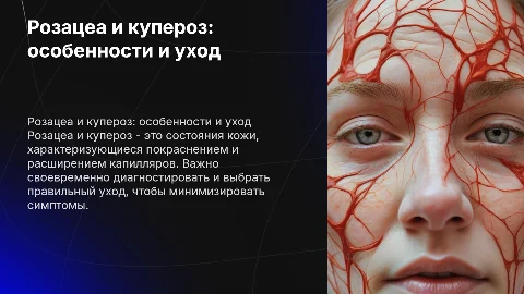 розацеа купероз