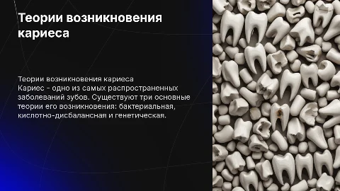 3 теории возникновения кариеса