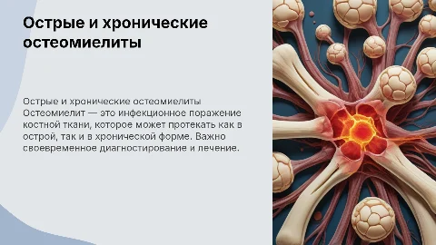 Острые и хронические остеомиелиты