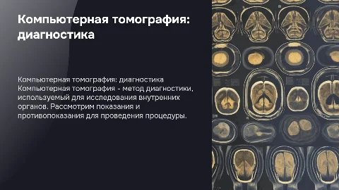 Компьютерная томография: показания и противопоказания