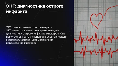 экг острый инфаркт миокарда