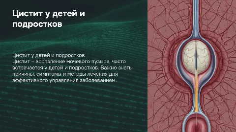 Цистит у детей и подростков: этиология, диагностика и лечение