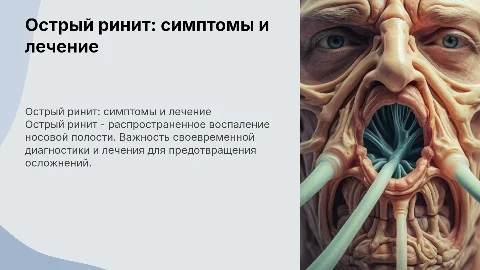 Острый ринит: клиника, диагностика, лечение
