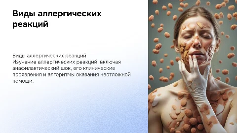 Анафилактический шок: клиника и алгоритм помощи
