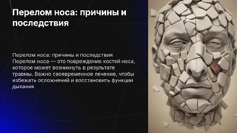 Перелом носа