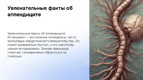Интересные факты про аппендицит