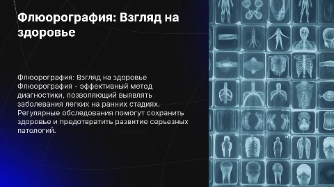 Флюорография. Здоровье в проекции
