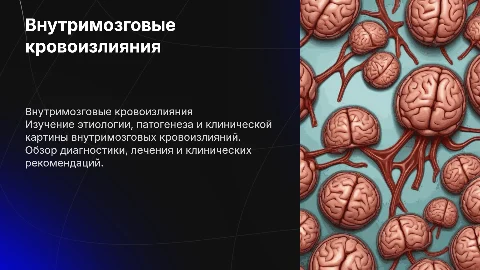 Внутримозговые кровоизлияния: этиология, диагностика и лечение