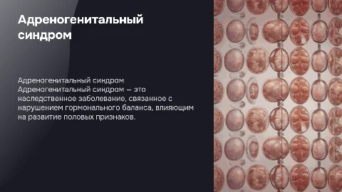 Адреногенитальный синдром