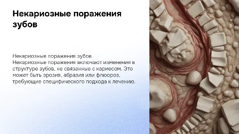 некариозные поражения твердых тканей зубов