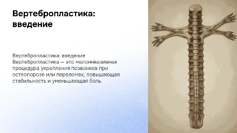 Вертебропластика