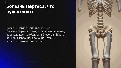 Болезнь Пертеса