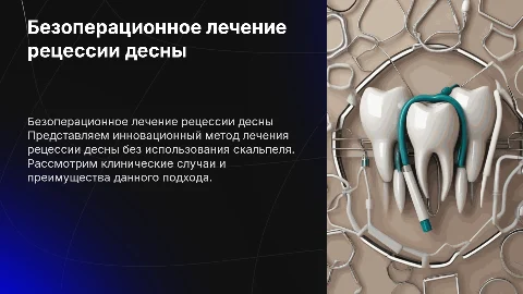Новый метод лечения рецессии десны без скальпеля