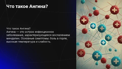 Ангина