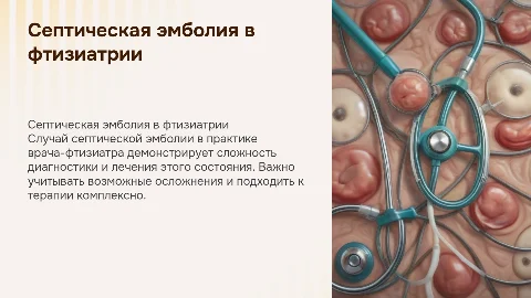 Случай септической эмболии в практике врача - фтизиатра