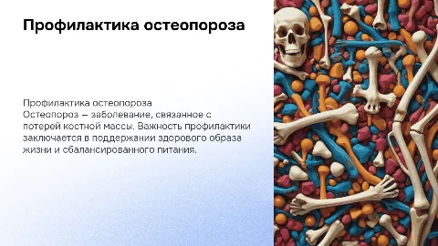 Профилактика остеопороза