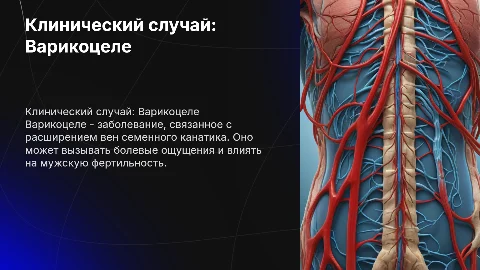 Клинический случай : Варикоцеле