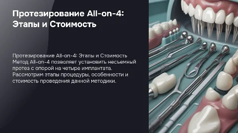 Протезирование методом All-on-4: этапы и стоимость