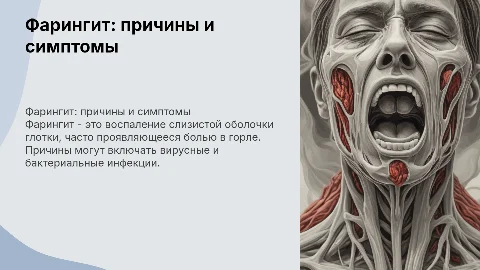 фарингит