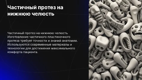 Технология изготовления частичного пластиночного протеза