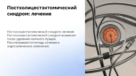 Постхоличистэктомический синдром. Лечение и эндоскопические изменения