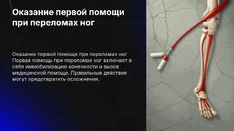 Оказание первой помощи при переломах ног