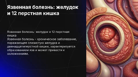 Язвенная болезнь желудка и 12 перстной кишки