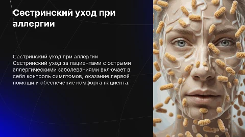 Сестринский уход при острых аллергических заболеваниях