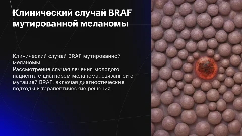 Клинический случай лечения BRAF мутированной меланомы