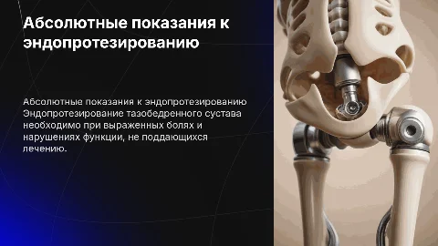 Абсолютные показания к эндопротезированию тазобедренного сустава
