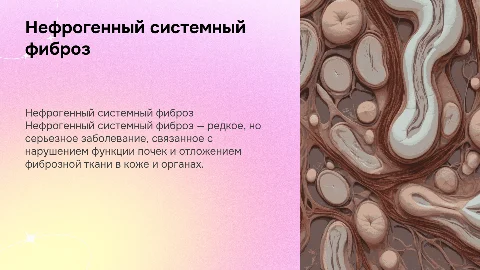 Нефрогенный системный фиброз