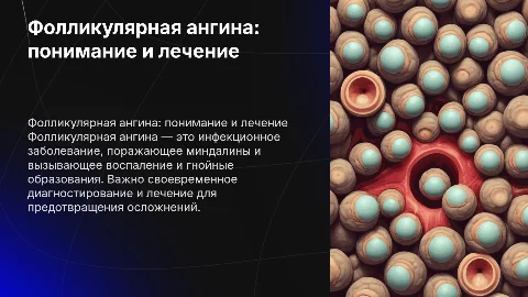 фолликулярная ангина