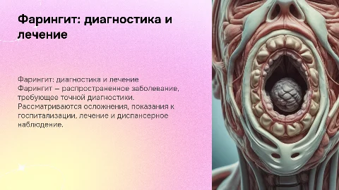 Фарингит: диагностика, лечение и диспансерное наблюдение